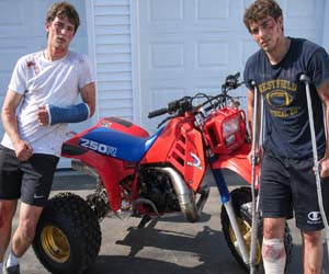 dangerous twist throttle injuries